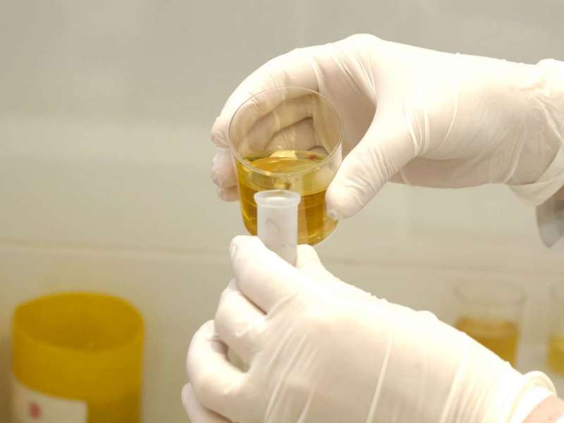 Does Synthetic Urine Actually Work? Slyng