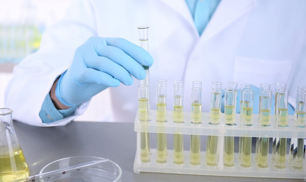 Does Synthetic Urine Work for Lab Tests? Slyng